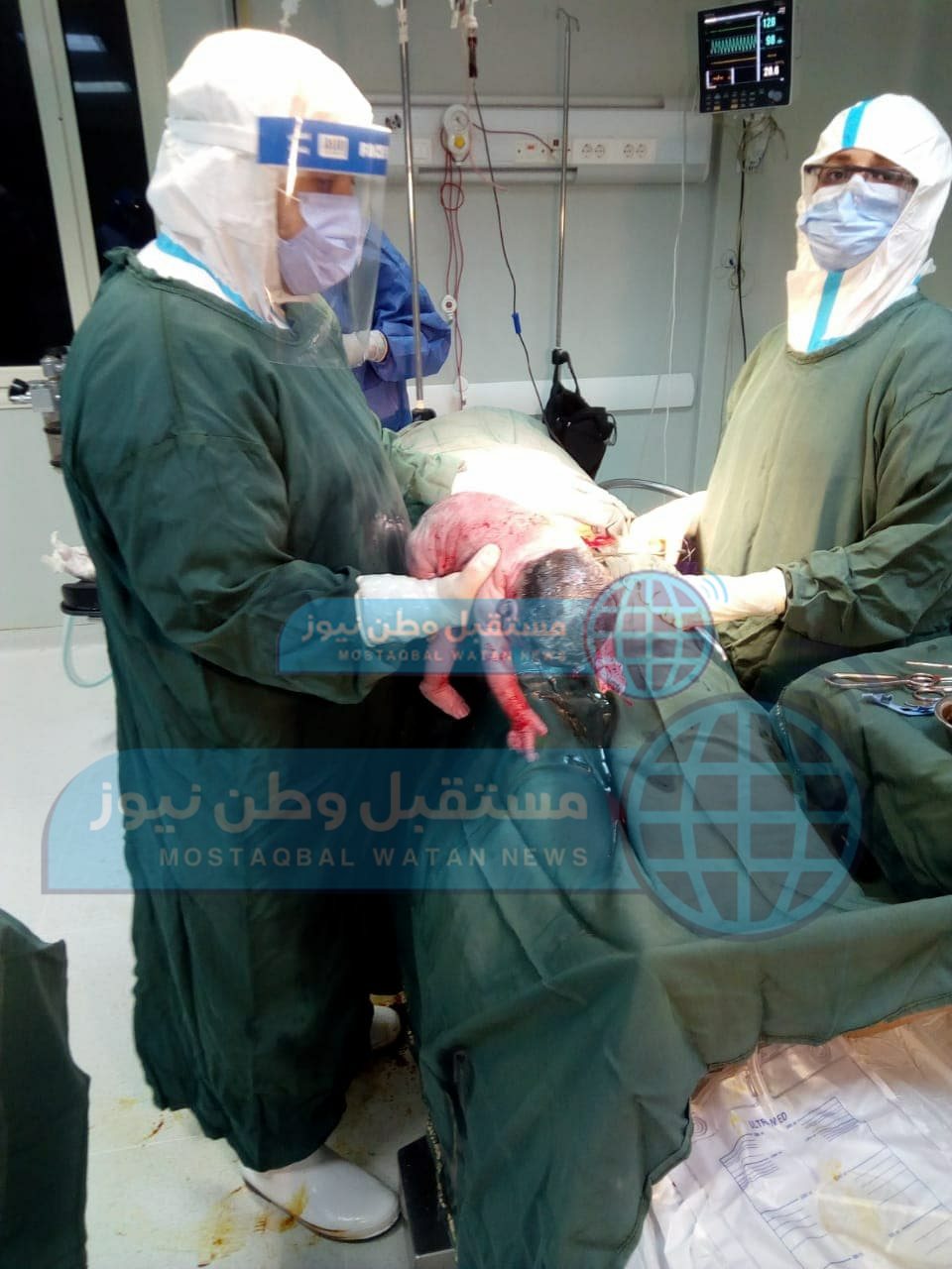 ولادة قيصرية لمصابة كورونا داخل مستشفى الخارجة (5)