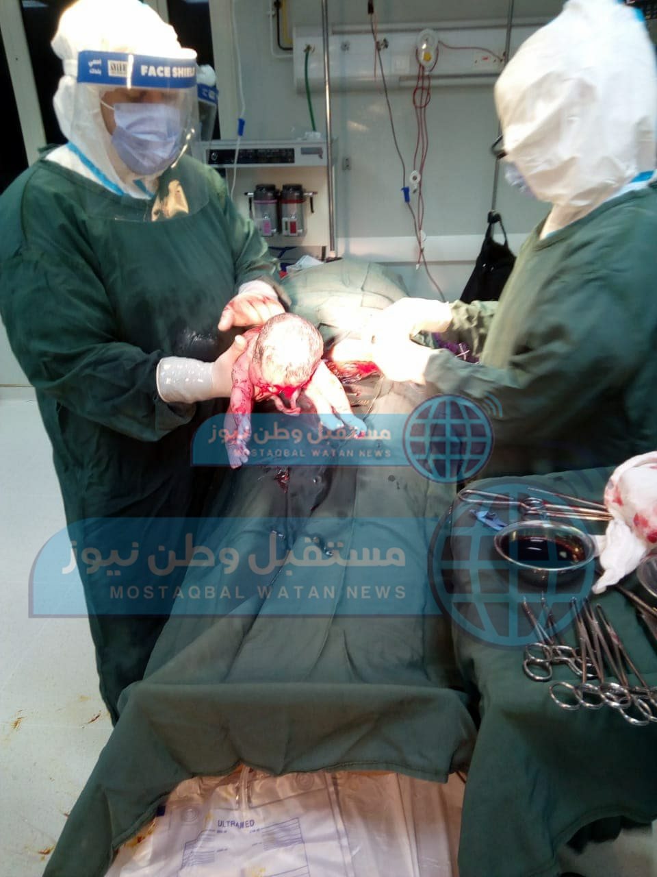 ولادة قيصرية لمصابة كورونا داخل مستشفى الخارجة (6)